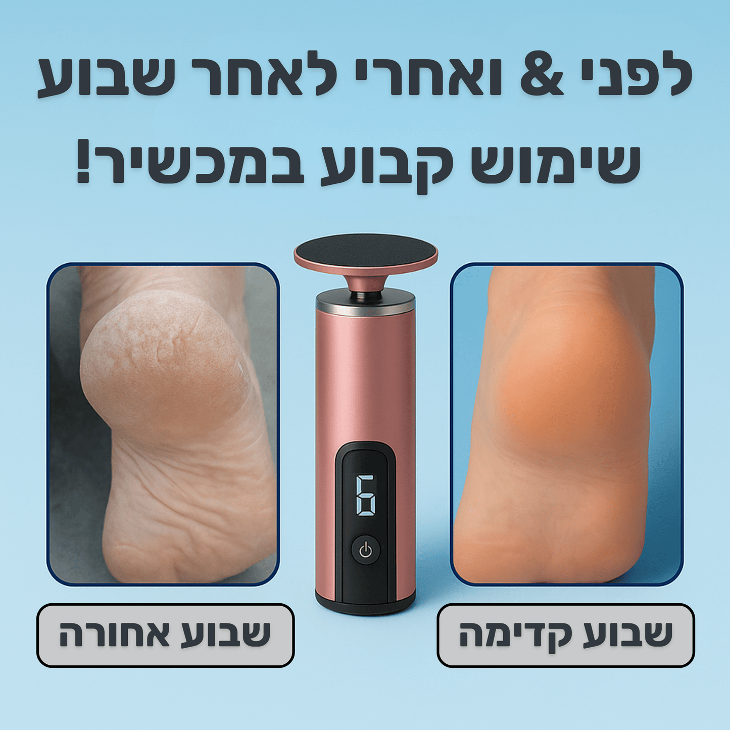 SORINA - פדיקור חשמלי