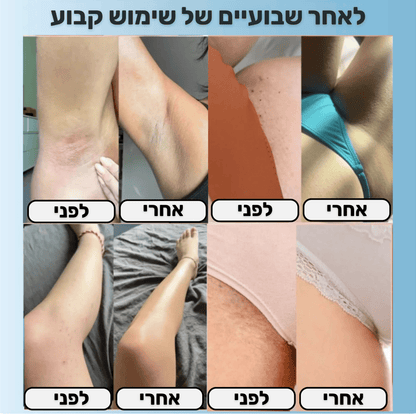 מכונת הגילוח- SORINA